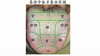 中医舌诊透过舌苔洞察健康奥秘