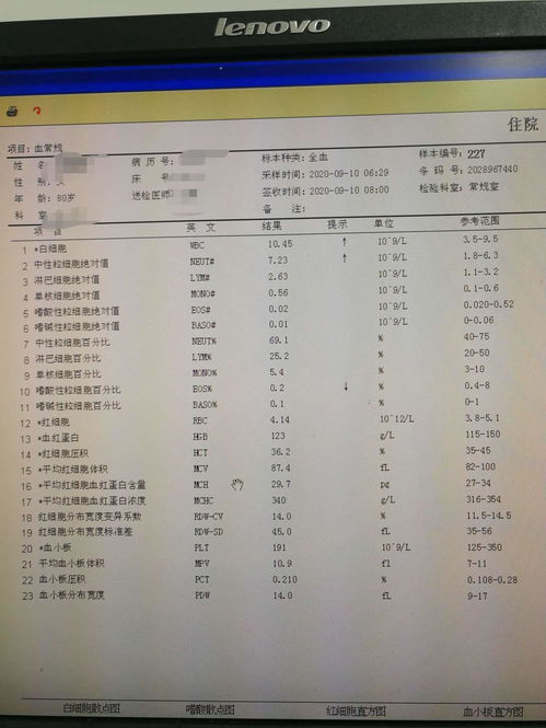 丹毒治疗探索最佳疗法的综合视角