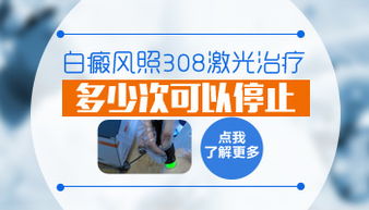 养生达人揭秘石家庄治疗白癜风医院全方位指南