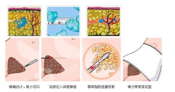 全方位揭秘，腹部减肥的高效策略与科学实践