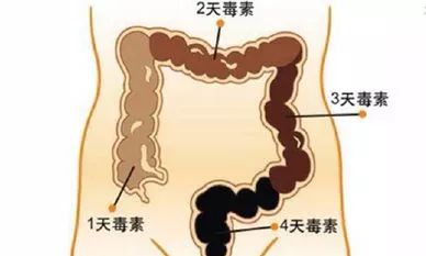 养护肠道，远离粘连，全方位解析肠粘连的预防与治疗策略