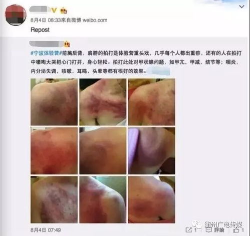 全面了解淋病，病症特征与养生保健之道