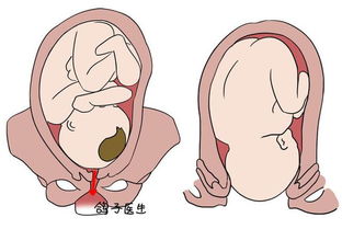 全方位解析，阴囊潮湿的调理之道——食疗秘籍与健康指南