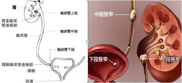 全面攻略，寻觅治疗痤疮的医疗圣殿——从专业医院到综合疗法