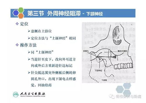 深度解析，喉咙痛的全方位原因探析与养生妙招