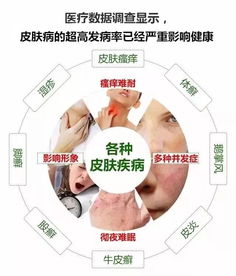 全面解读牛皮癣症状，养生达人带你科学应对皮肤顽疾