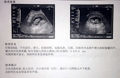 孕期健康指南，解读孕囊掉落的生理与养护智慧