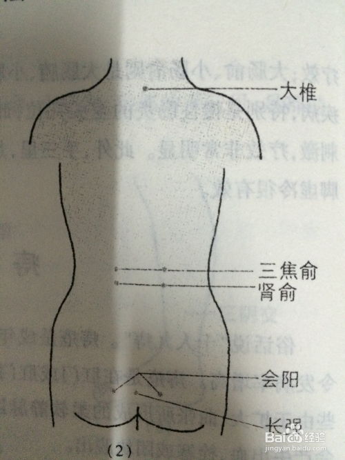 远离疼痛，守护肛肠——全面解析痔疮防治与养生之道