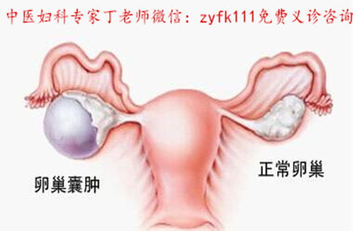 全面解读，不孕不育的常见症状与养生调理策略