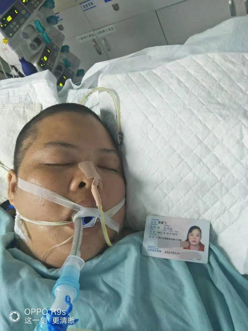 32岁网红下播后突发脑出血进ICU