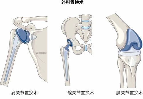 儿童鼻出血的全方位解析与养生指南——七种原因及应对策略