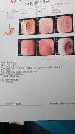 肠胃检查项目有哪些多少钱