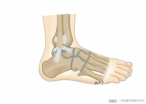 全方位解析，脚踝扭伤肿胀的养生之道