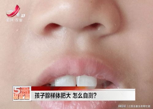 揭秘腺样体与容貌的微妙关联，养生达人的全面解读