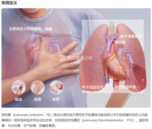 揭秘养生达人眼中的漏斗胸，科学矫正与生活调养全攻略