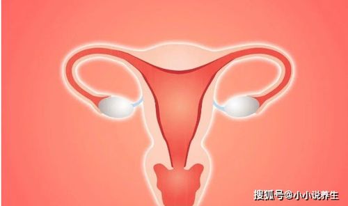 女性尖锐湿疣，认识、症状与健康守护全攻略