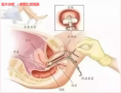 全方位解析，生殖器疱疹的科学治疗与养生之道