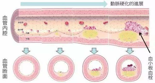 深度解析，载脂蛋白A1——健康血脂管理的隐形守护者