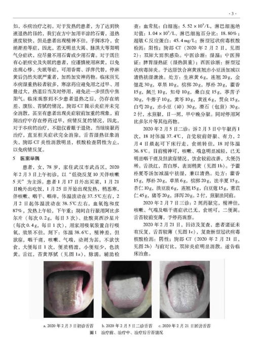 探索上海痤疮诊疗天堂，综合指南与最佳选择