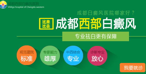 成都癫痫诊疗指南——探寻最专业、全面的癫痫治疗天堂