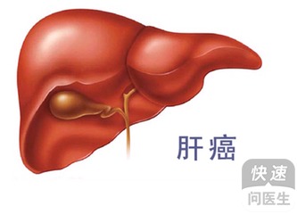 全面解析，霉菌感染的警惕信号与养生对抗之道