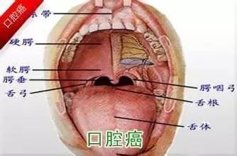 揭秘口腔溃疡，那些不为人知的触发因素与对策