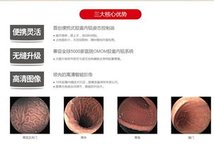 揭秘胃肠彩超，无痛探秘消化道健康的小能手