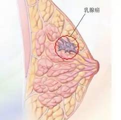 解读白带带血丝，原因、信号与健康指南