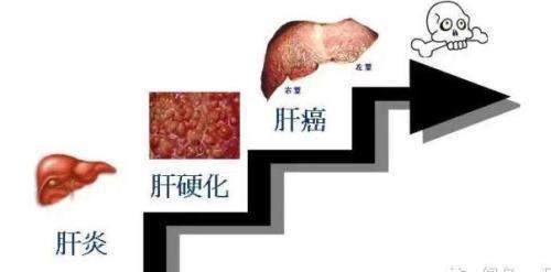 谷草转氨酶偏高的秘密探析，原因、影响与对策