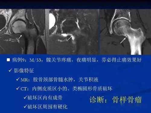 掌握正确路径，全面解析淋病的诊断与治疗之道