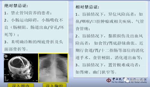 揭秘鼻子的出血密码，原因、应对与日常保养