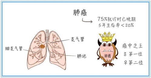 健康守护甲状腺肿大的隐形隐形朋友，科学对策与日常生活指南